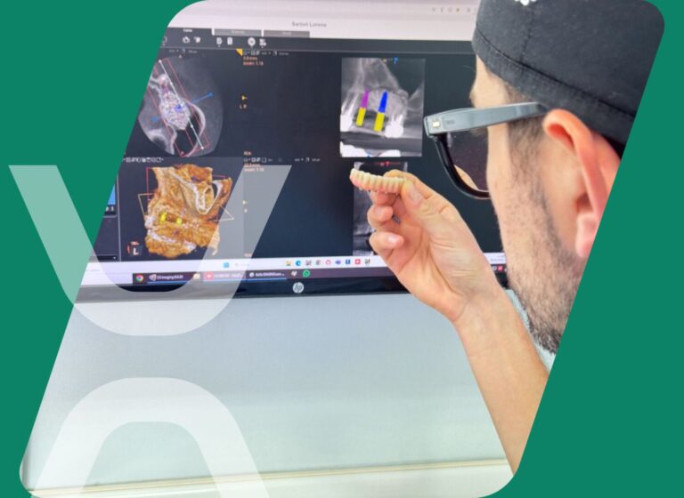 impl computer guid COPERTINA BLOG 5 implantologia computer guidata